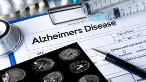 Повратна точка в лечението на Алцхаймер: Нов медикамент забавя развитието на болестта