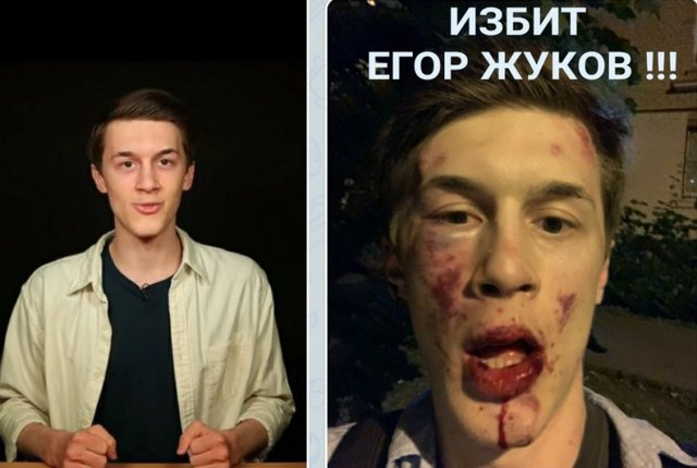 Егор Жуков преди и след нападението. Снимка Туитър
