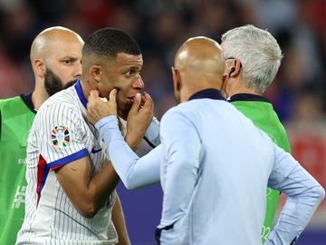 Паника във Франция: Мбапе "не е добре", може да пропусне два мача и ще му трябва маска