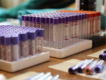 17-годишен ученик с ваксина е първият, заразен с коклюш във Велико Търново