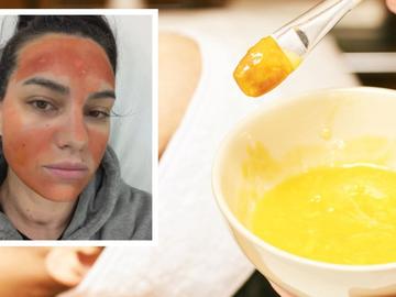 Отнеха регистрацията на салона, в който жена получи втора степен изгаряния