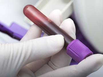 Кръвната проба на катастрофиралия пиян шеф на парк "Рила" показа близо 3 промила